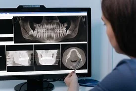 Dentist Mill Creek WA Digital X-Rays A dentist examining a patient's digital x-rays on a computer monitor
